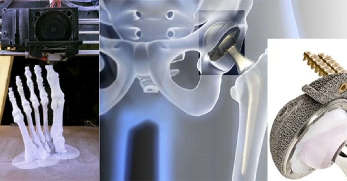 Reverse Engineering là gì? Công nghệ kỹ thuật ngược trong in 3D