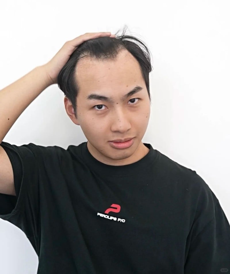 tóc ngắn cho trán cao nam