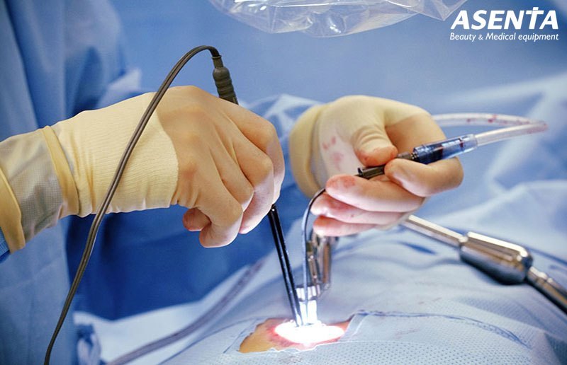 Vai trò quan trọng của dao mổ điện nên rất cần sự lựa chọn phù hợp