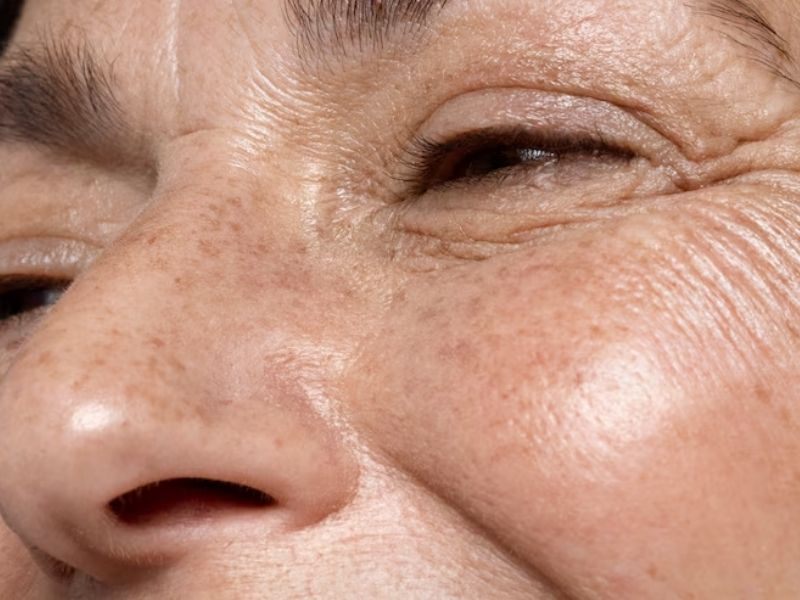 dau-hieu-da-bi-thieu-collagen