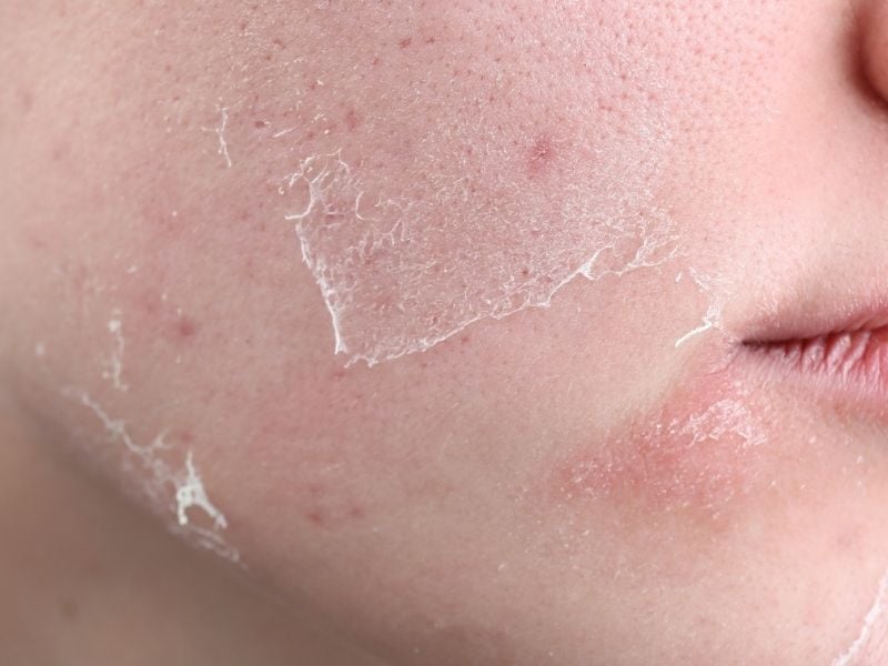 thieu-tu-tin-khi-da-kho