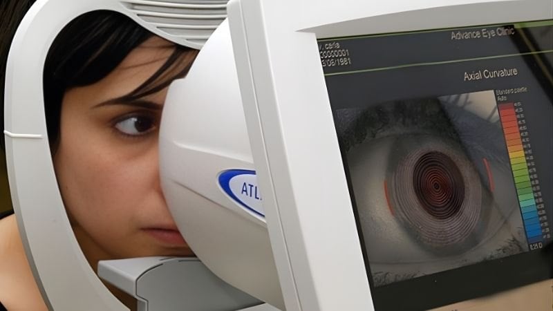 Bệnh nhân đang được chụp bản đồ giác mạc bằng hệ thống topography chuyên dụng.