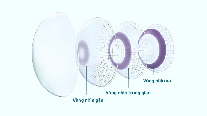 Kính áp tròng đa tiêu cự cho phép người đeo nhìn rõ ở mọi cự ly