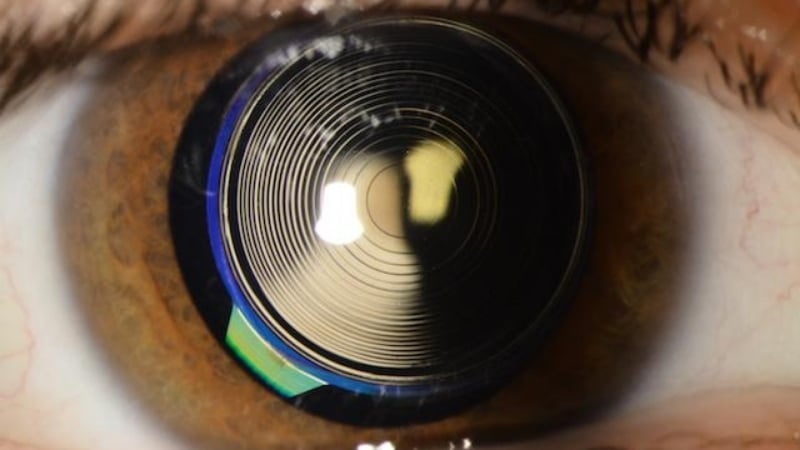 Kính nội nhãn đa tiêu cự giúp bệnh nhân đạt được sự tự chủ tối đa về thị lực