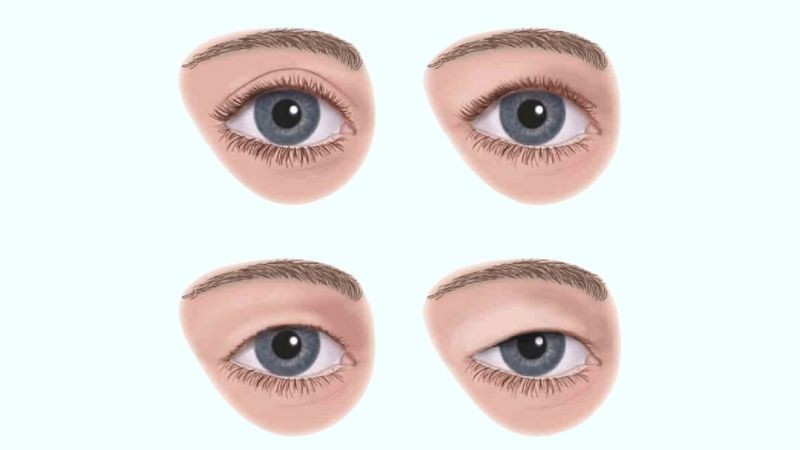 lao-hoa-lam-da-mat-dan-hoi