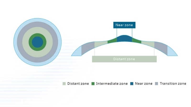 Sơ đồ đa vùng tiêu cự trên giác mạc khi điều trị bằng phương pháp PresbyMAX