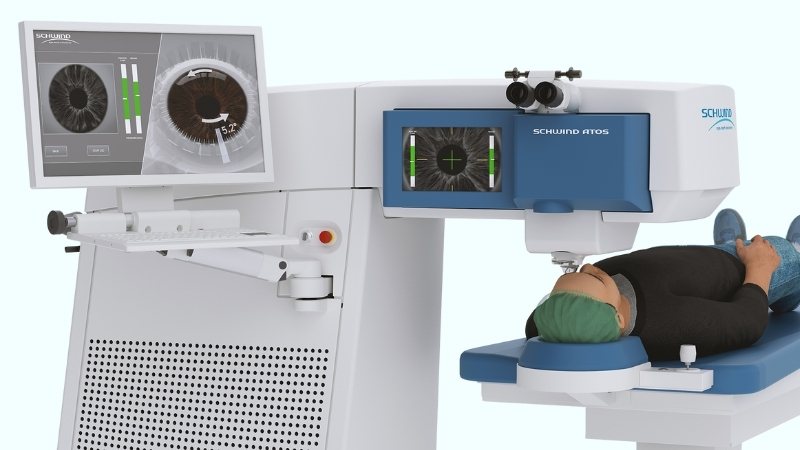 Phẫu thuật SmartSight là kỹ thuật phẫu thuật khúc xạ Lenticule Extraction