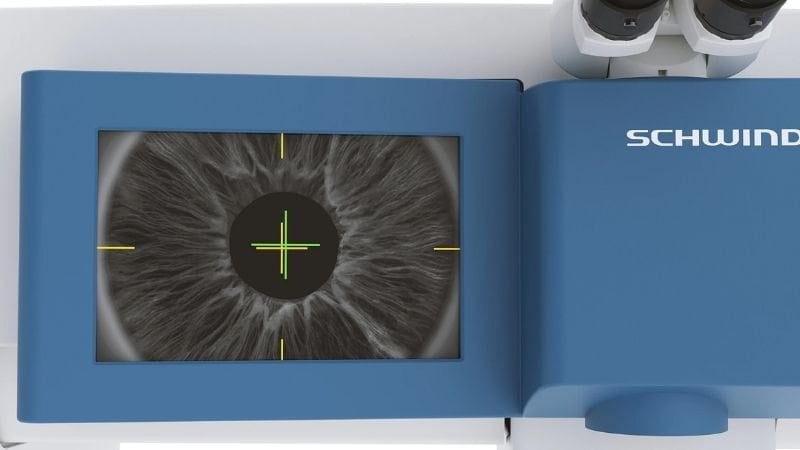 SmartSight đảm bảo tia laser luôn bắn chính xác vào đúng trục thị giác