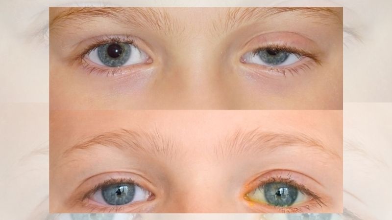 muc-dich-tao-hinh-mi