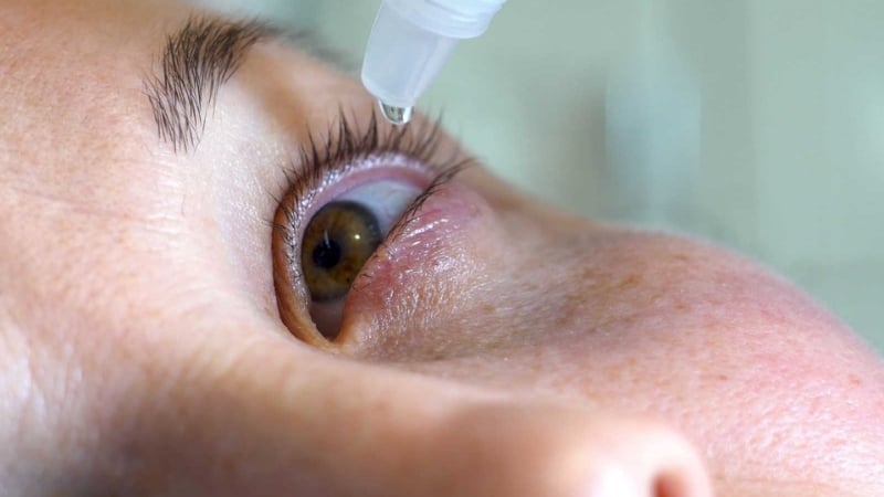 Vệ sinh bờ mi Blephex được chỉ định cho những bệnh nhân bị viêm bờ mi mạn tính