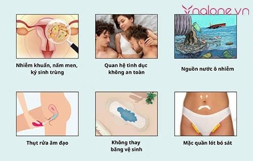 nguyên nhân gây viêm bộ phận sinh dục nữ là gì