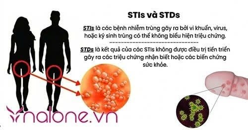 Bệnh xã hội là gì?