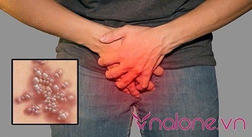 Có nên giặt bao cao su để dùng lại? Nguy cơ nhiễm bệnh