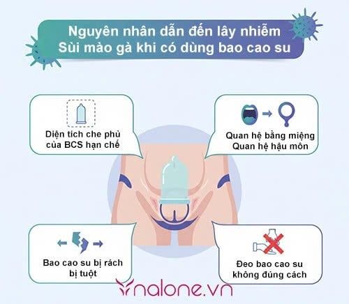 Đeo bao cao su có bị sùi mào gà không?