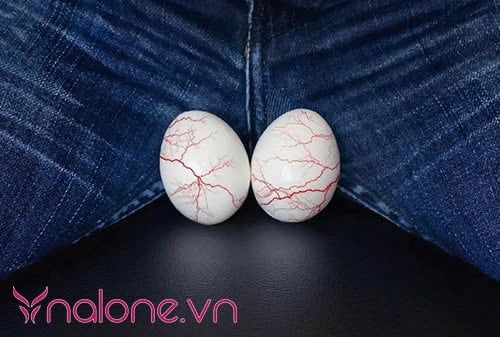 người nên đặt tinh hoàn nhân tạo là gì