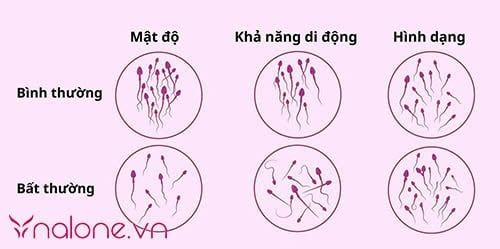 Tinh trùng loãng như nước có thụ thai được không? đặc điểm nhận biết