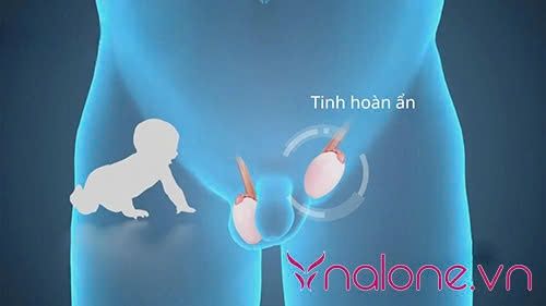 1 tinh hoàn có sinh con được không? Nguyên nhân từ đâu