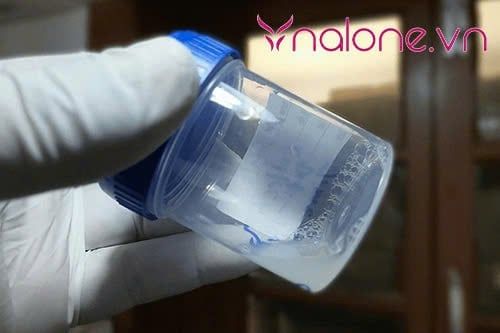 Tình trạng Tinh trùng loãng như nước có thụ thai được không