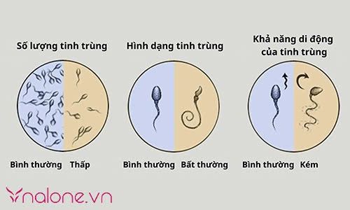 nguyên nhân gây hiếm muộn ở nam giới là gì