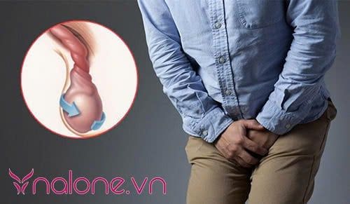 nam giới bị xoắn tinh hoàn có tự khỏi