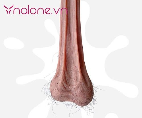 tinh hoàn xệ có bị vô sinh không nguyên nhân do đâu