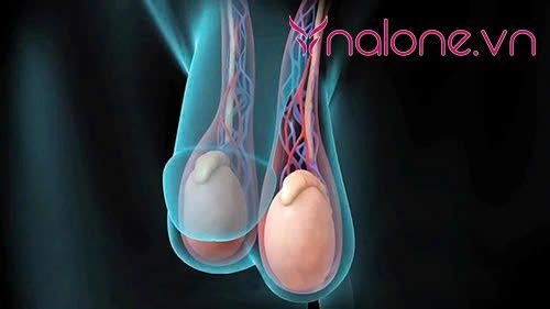 tình trạng tinh hoàn xệ có bị vô sinh không