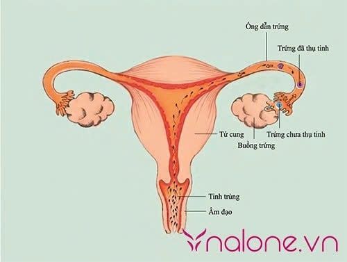 Tinh trùng bị trào ra ngoài bao cao su thì có thai không?