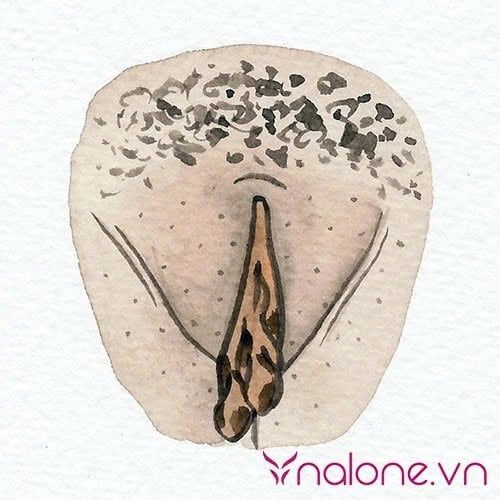 Tại sao vùng kín bị thâm?