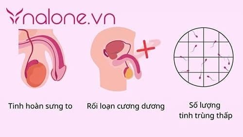 triệu chứng vô sinh là gì ở nam giới