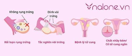 nguyên nhân gây vô sinh là gì ở nữ giới