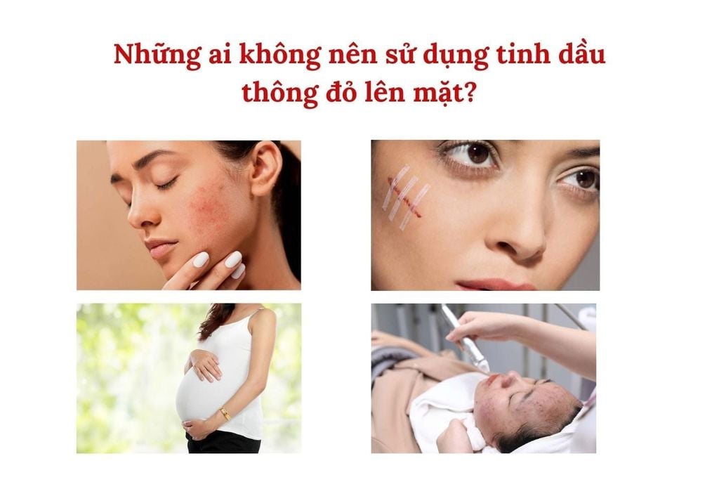 Đối tượng cần tránh bôi tinh dầu thông đỏ trực tiếp lên da mặt
