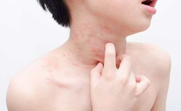 Các thành phần mỹ phẩm cần tuyệt đối tránh