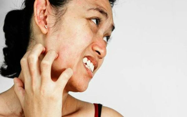 Cách chăm sóc và phục hồi da sau khi bị dị ứng