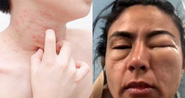 Dấu hiệu cần đi gặp bác sĩ ngay