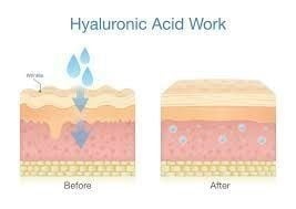 Những ai nên và không nên dùng Hyaluronic Acid