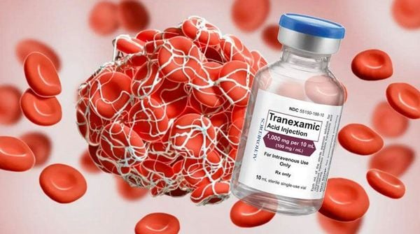 Tranexamic Acid (TXA)
