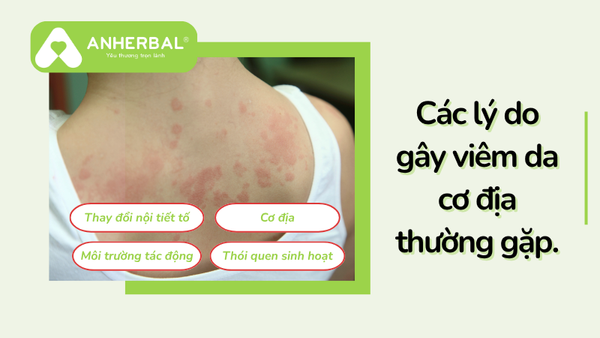 lý do gây viêm da cơ địa thường gặp