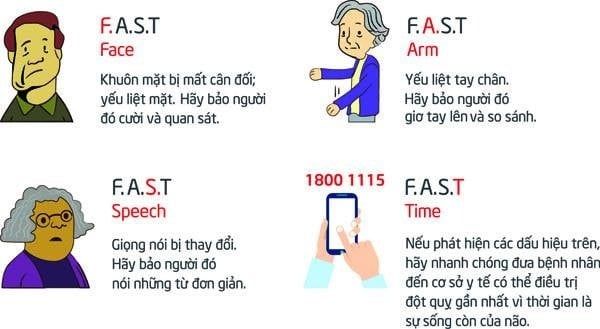 so sánh quy tắc đột quỵ BE FAST và FAST 1