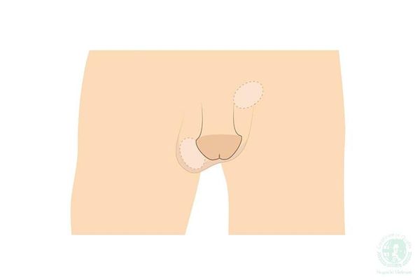 Hình ảnh sản phẩm