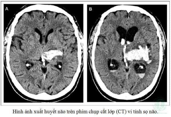 Hình ảnh sản phẩm
