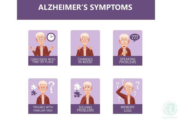 tìm hiểu bệnh alzheimer sống được bao lâu