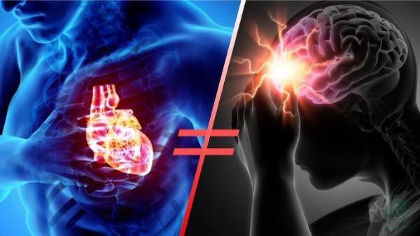 phân biệt đột quỵ và đột tử