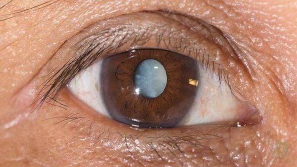 Hình ảnh sản phẩm