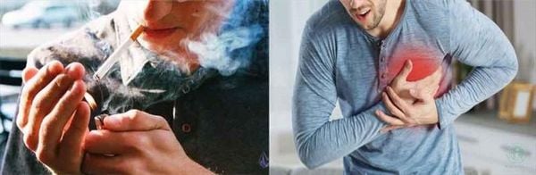 Hình ảnh sản phẩm