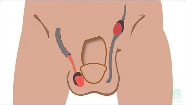 Hình ảnh sản phẩm