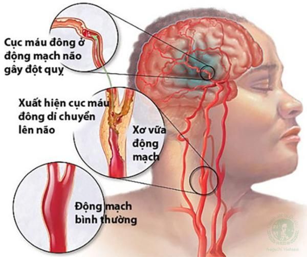 Hình ảnh sản phẩm