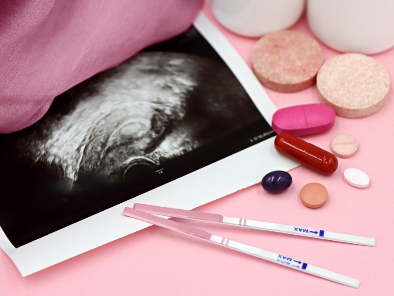 Buồng trứng đa nang nhẹ là gì? Tiêu chuẩn chẩn đoán và khả năng thụ thai