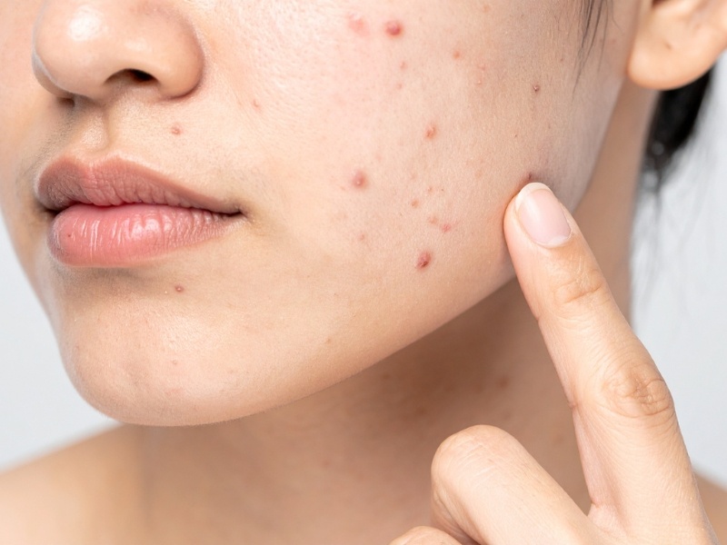 Hyperinsulinemia là gì? Nguyên nhân, dấu hiệu và nguy cơ kháng insulin tiềm ẩn