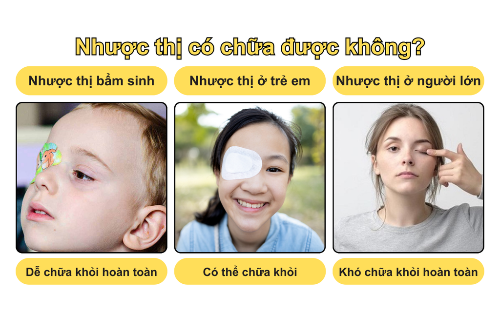 nhuoc-thi-co-chua-duoc-khong-theo-tung-do-tuoi