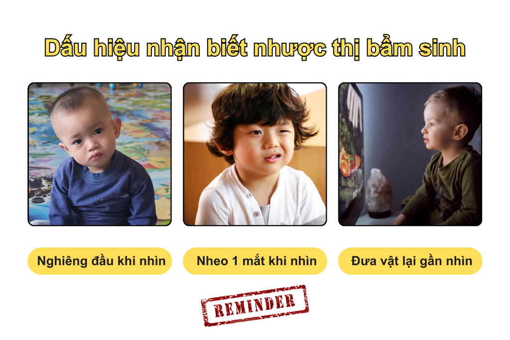 dau-hieu-nhan-biet-nhuoc-thi-bam-sinh